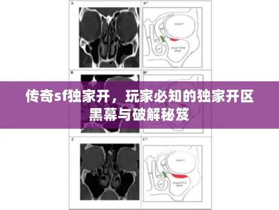 传奇sf独家开，玩家必知的独家开区黑幕与破解秘笈