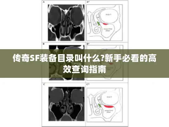 传奇SF装备目录叫什么?新手必看的高效查询指南