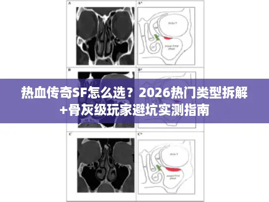 热血传奇SF怎么选？2026热门类型拆解+骨灰级玩家避坑实测指南
